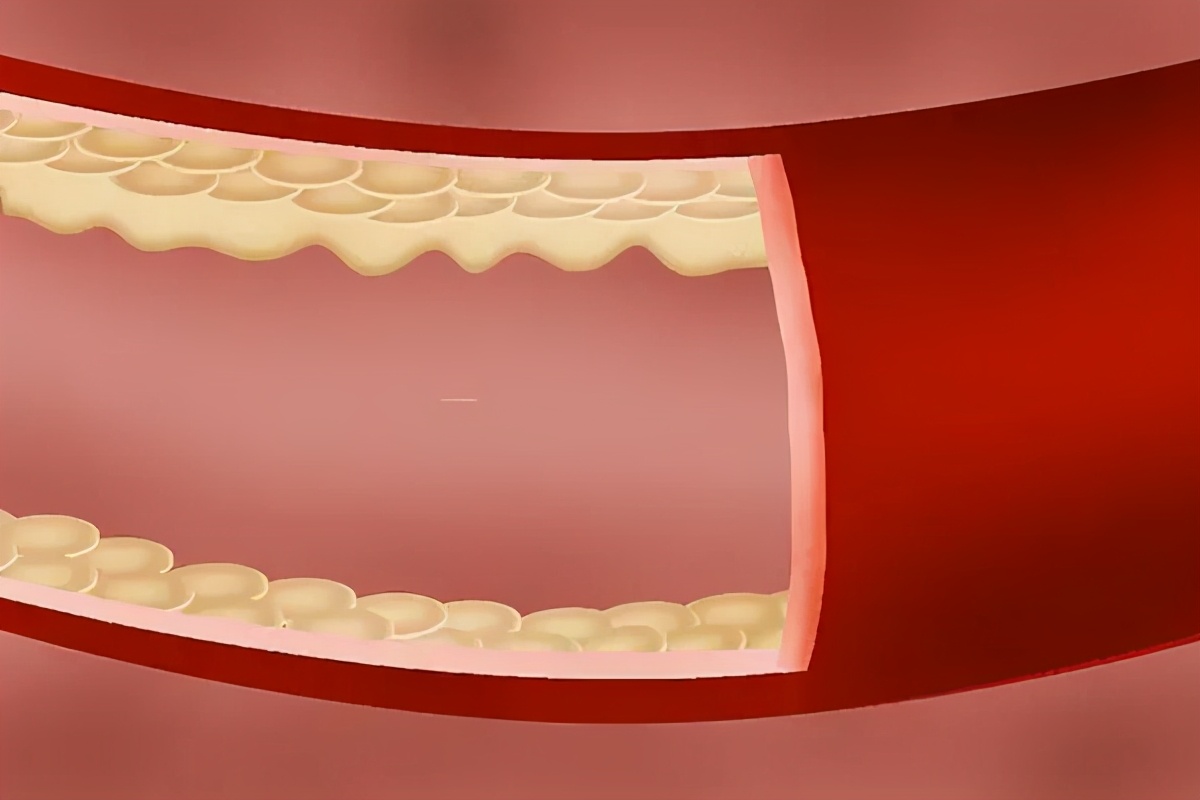 俗話說�酒為百藥長�，活血化瘀，每天喝1兩酒，身體會獲益嗎？