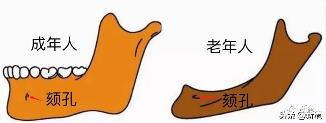 为什么蔡少芬身上的美人感逐渐消失了?
