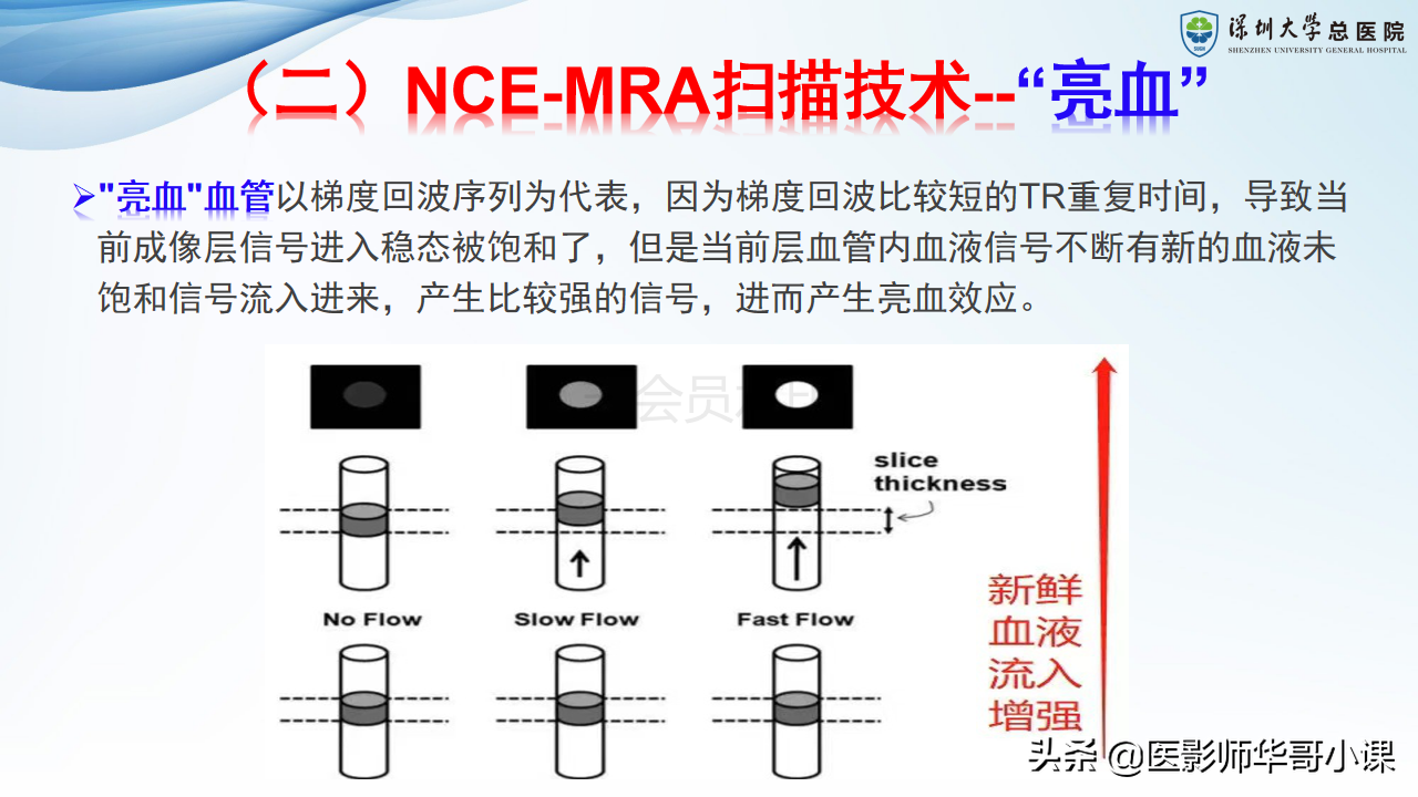 磁共振非增强双下肢血管MRA