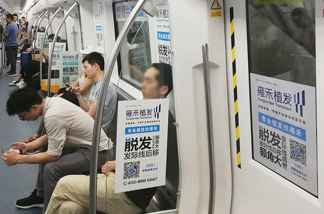 一个毛囊20元!“秃”顶焦虑催生千亿生意,植发的水有多深?