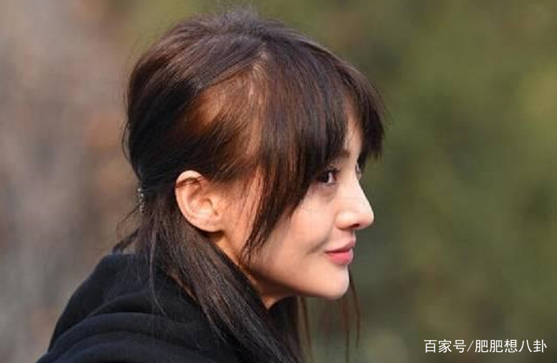 郑爽也遭遇掉发危机了？用生发梳被网友催早睡