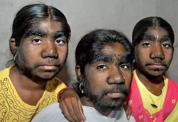 出现“返祖现象”？人类是进化还是退化？