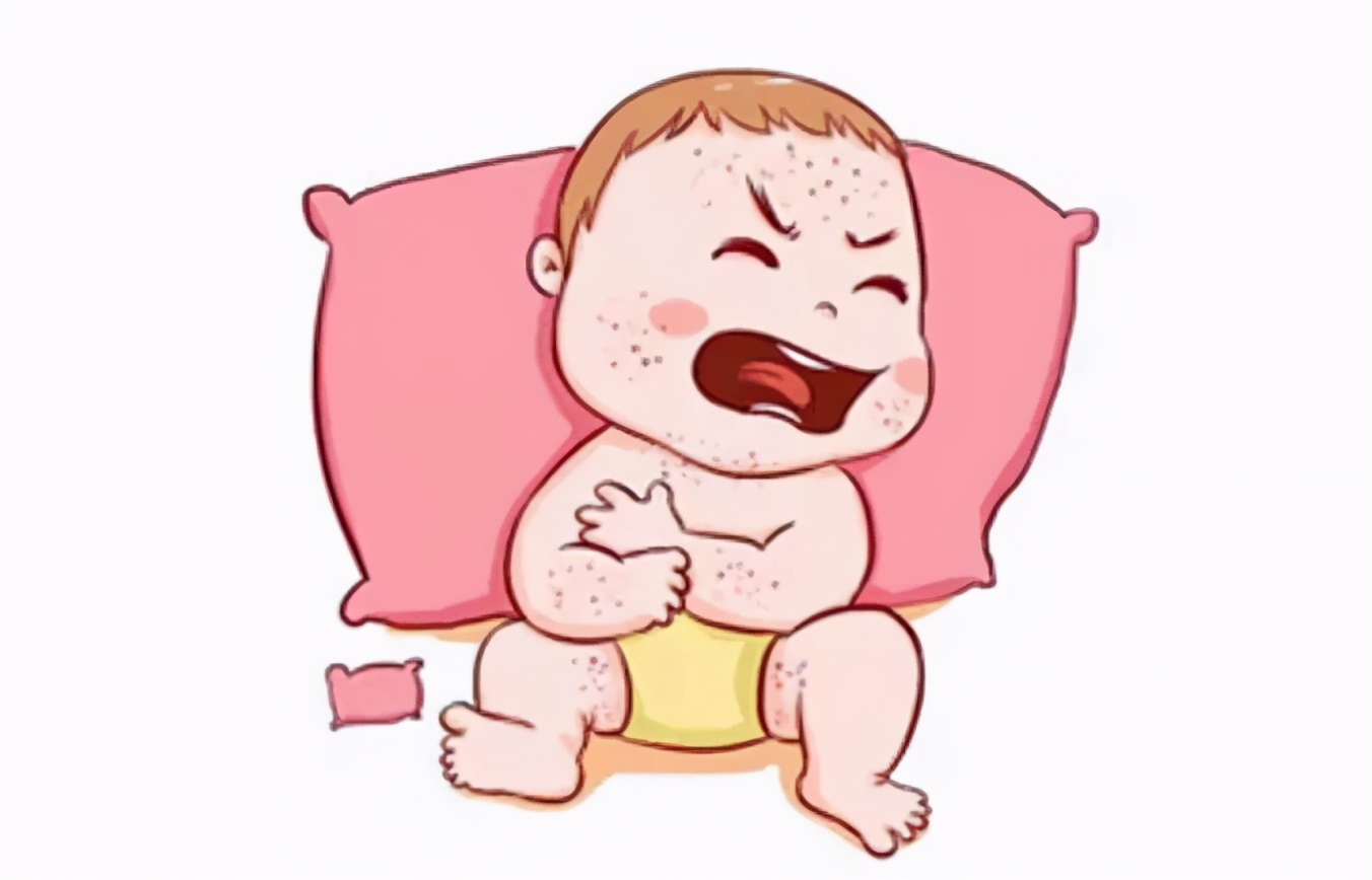 为什么宝宝会出现湿疹？|animation|Short Story / Frame Comics|嘉玲_Original作品-站酷(ZCOOL)